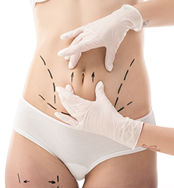 360°-Hi-Def-Liposuction-dr-h-3